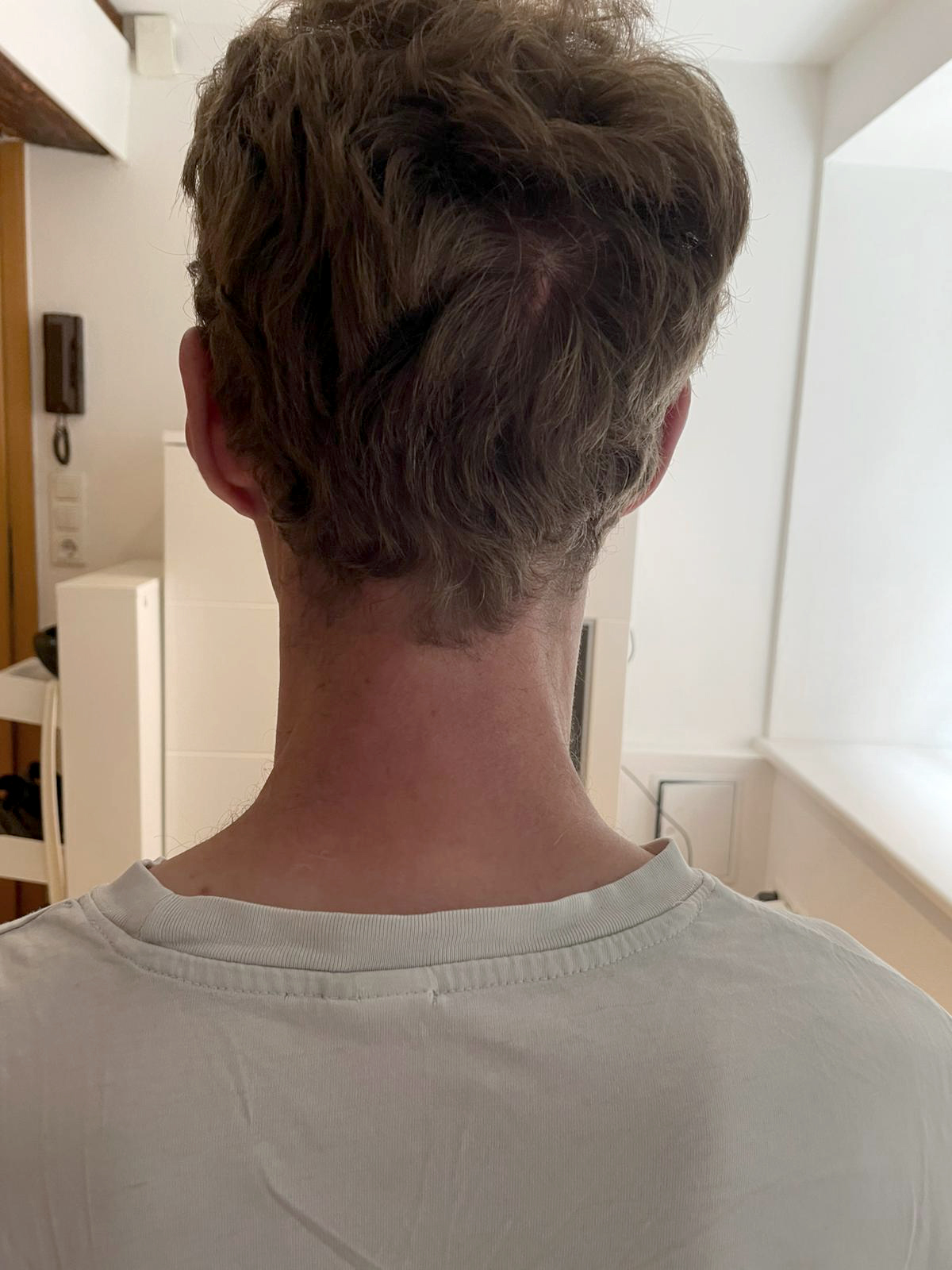 Thai Massage Behandlung Nachher - Sichtbare Verbesserung nach 3 Behandlungen durch Amy Mongkhon